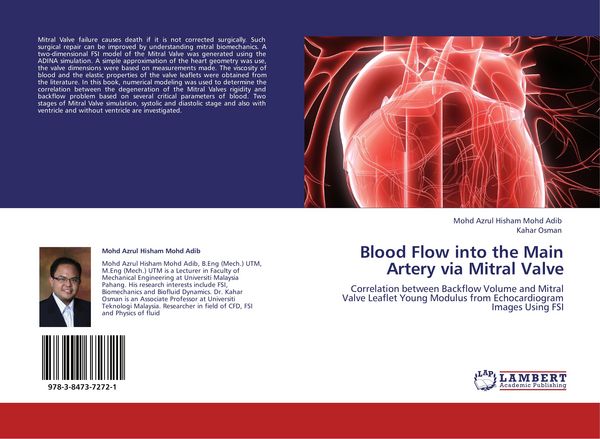 Produktbild: Blood Flow into the Main Artery via Mitral Valve