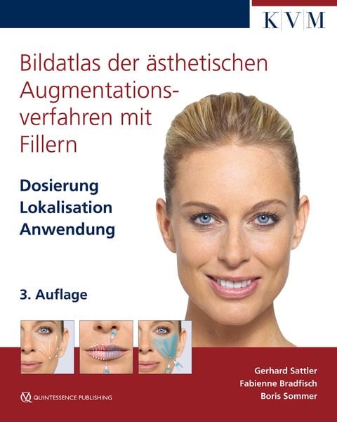 Produktbild: Bildatlas der ästhetischen Augmentationsverfahren mit Fillern