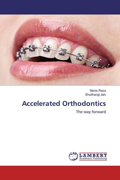 Produktbild: Accelerated Orthodontics