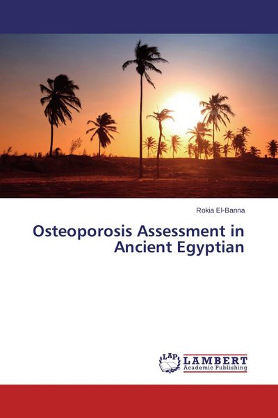 Produktbild: Osteoporosis Assessment in Ancient Egyptian