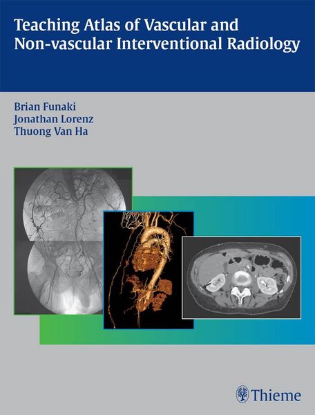 Produktbild: Teaching Atlas of Vascular and Non-vascular Interventional Radiology