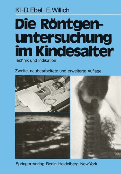 Produktbild: Die R&ouml;ntgenuntersuchung im Kindesalter