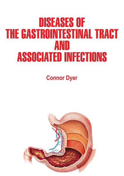 Produktbild: Diseases of the Gastrointestinal Tract and Associated Infections