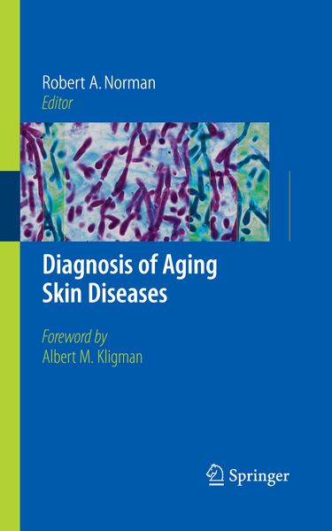 Produktbild: Diagnosis of Aging Skin Diseases