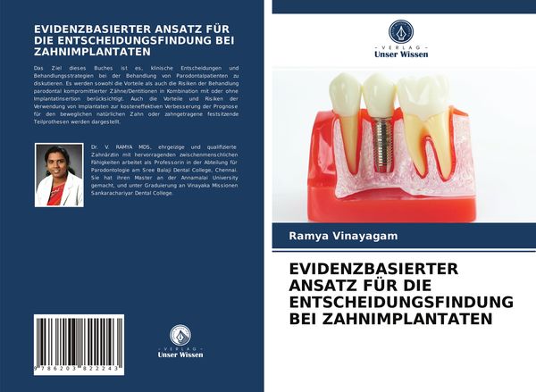 Produktbild: Evidenzbasierter Ansatz f&uuml;r die Entscheidungsfindung bei Zahnimplantaten