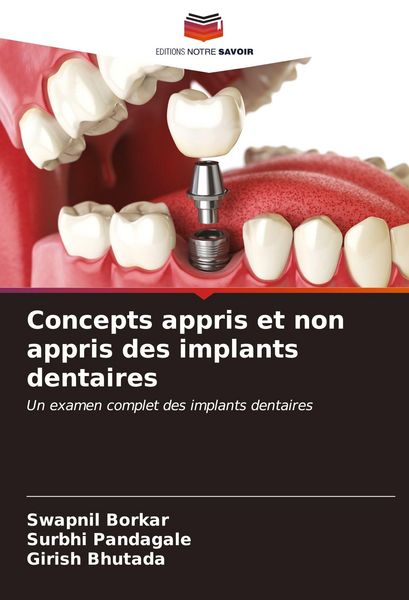 Produktbild: Concepts appris et non appris des implants dentaires