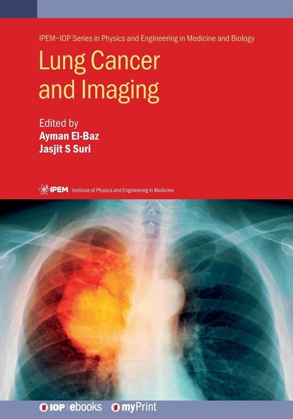 Produktbild: Lung Cancer and Imaging