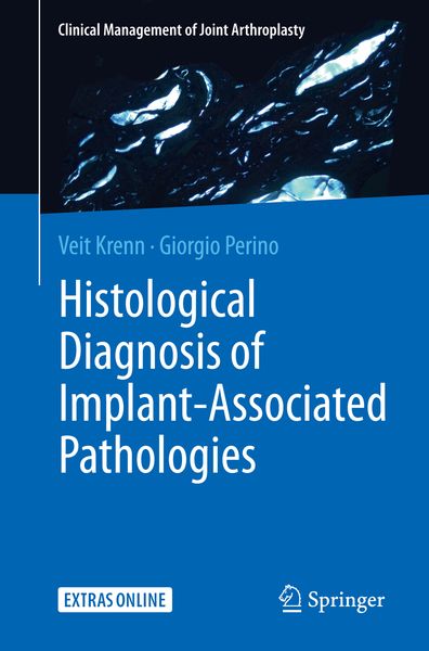 Produktbild: Histological Diagnosis of Implant-associated Pathologies