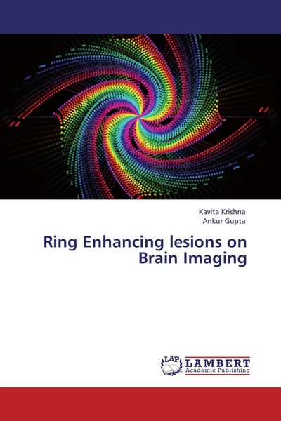 Produktbild: Ring Enhancing lesions on Brain Imaging