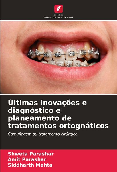 Produktbild: &Uacute;ltimas inova&ccedil;&otilde;es e diagn&oacute;stico e planeamento de tratamentos ortogn&aacute;ticos