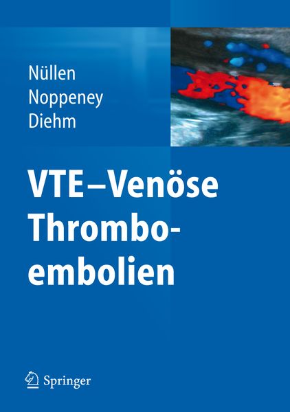 Produktbild: VTE - Ven&ouml;se Thromboembolien