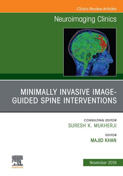 Produktbild: Spine Intervention, An Issue of Neuroimaging Clinics of North America