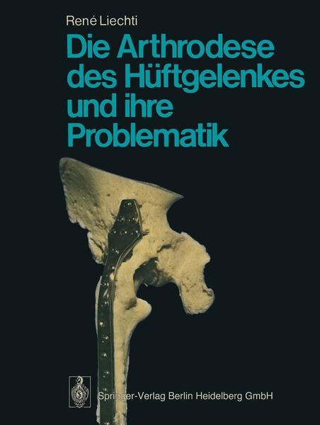 Produktbild: Die Arthrodese des H&uuml;ftgelenkes und ihre Problematik