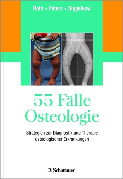 Produktbild: 55 F&auml;lle Osteologie