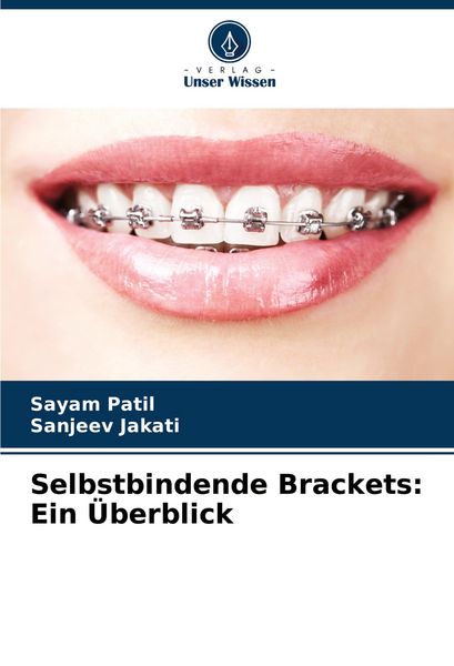 Produktbild: Selbstbindende Brackets: Ein &Uuml;berblick