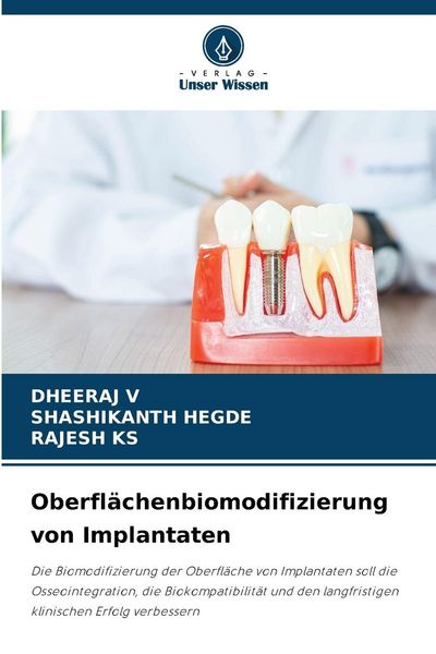 Oberflächenbiomodifizierung von Implantaten, Taschenbuch von Dheeraj V. , Shashikanth Hegde , Rajesh Ks, Verlag Unser Wissen, 9786209368455