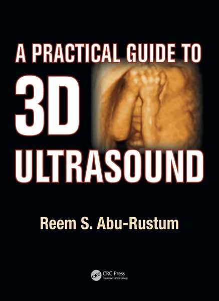 Produktbild: A Practical Guide to 3D Ultrasound