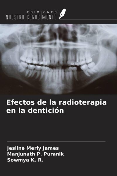 Produktbild: Efectos de la radioterapia en la dentici&oacute;n