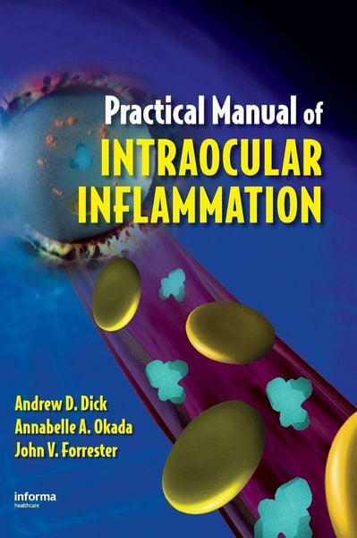 Produktbild: Practical Manual of Intraocular Inflammation