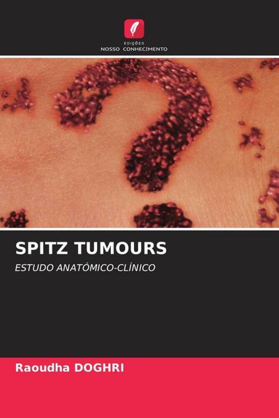 Produktbild: Spitz Tumours