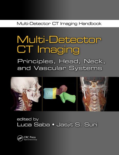Produktbild: Multi-Detector CT Imaging
