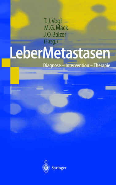 Produktbild: LeberMetastasen