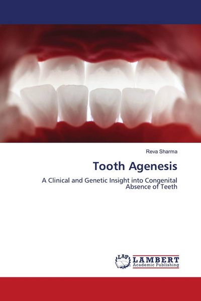 Produktbild: Tooth Agenesis