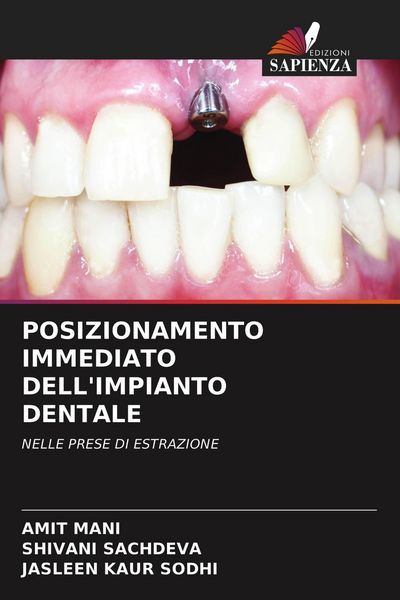 Produktbild: POSIZIONAMENTO IMMEDIATO DELL'IMPIANTO DENTALE