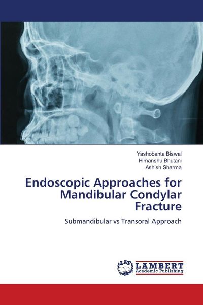 Produktbild: Endoscopic Approaches for Mandibular Condylar Fracture