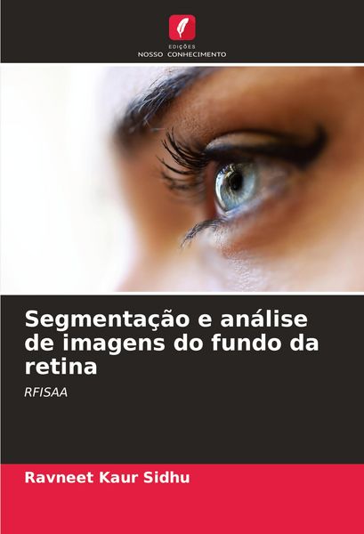 Produktbild: Segmenta&ccedil;&atilde;o e an&aacute;lise de imagens do fundo da retina