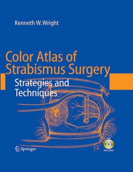 Produktbild: Color Atlas of Strabismus Surgery