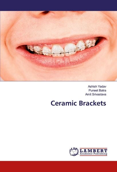 Produktbild: Ceramic Brackets