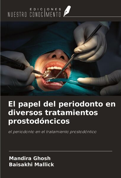 Produktbild: El papel del periodonto en diversos tratamientos prostod&oacute;ncicos