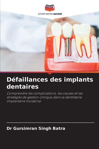 Produktbild: D&eacute;faillances des implants dentaires