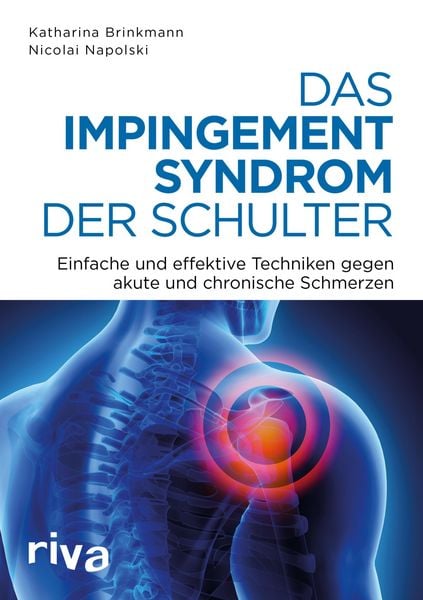 Produktbild: Das Impingement-Syndrom der Schulter