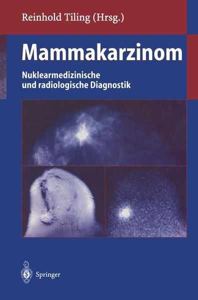 Produktbild: Mammakarzinom