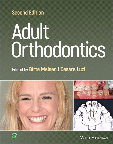 Produktbild: Adult Orthodontics