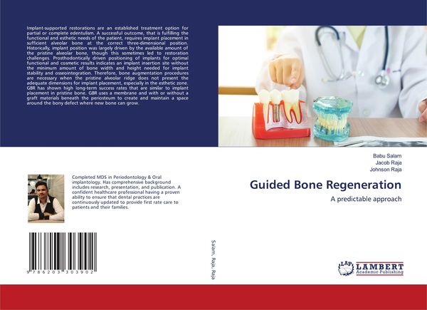 Produktbild: Guided Bone Regeneration