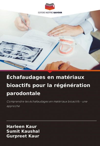 Produktbild: &Eacute;chafaudages en mat&eacute;riaux bioactifs pour la r&eacute;g&eacute;n&eacute;ration parodontale