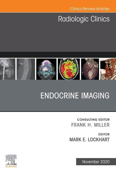 Produktbild: Endocrine Imaging, An Issue of Radiologic Clinics of North America, E-Book