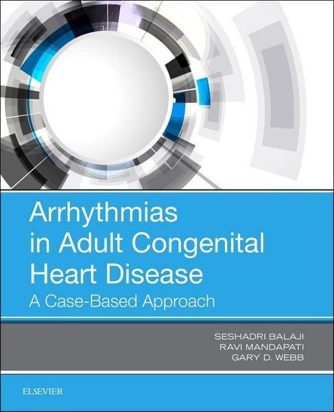 Produktbild: Arrhythmias in Adult Congenital Heart Disease