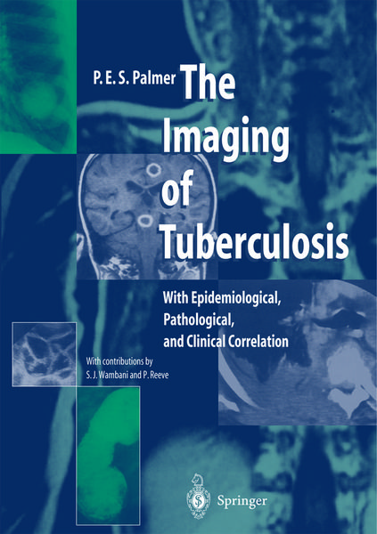 Produktbild: The Imaging of Tuberculosis