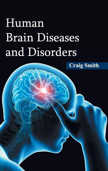 Produktbild: Human Brain Diseases and Disorders