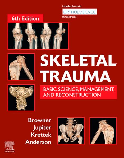 Produktbild: Skeletal Trauma E-Book