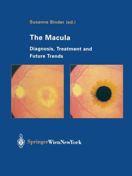 Produktbild: The Macula