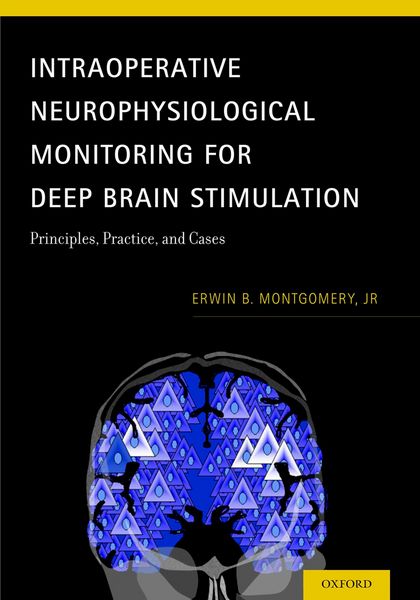 Produktbild: Intraoperative Neurophysiological Monitoring for Deep Brain Stimulation