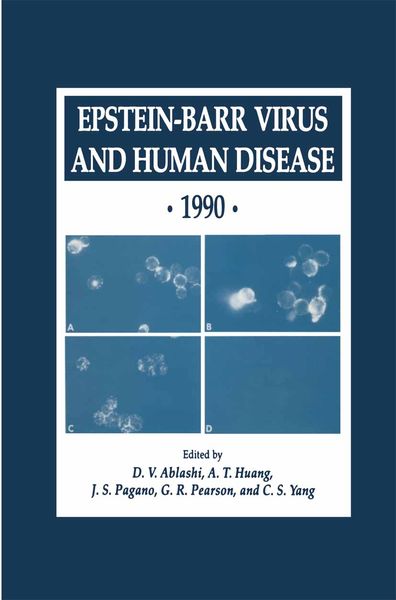 Produktbild: Epstein-Barr Virus and Human Disease &middot; 1990
