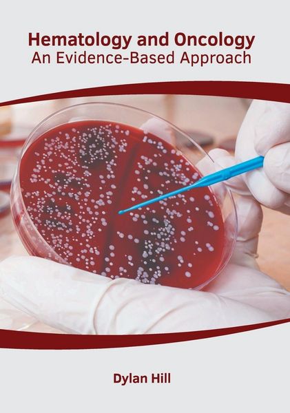 Produktbild: Hematology and Oncology: An Evidence-Based Approach