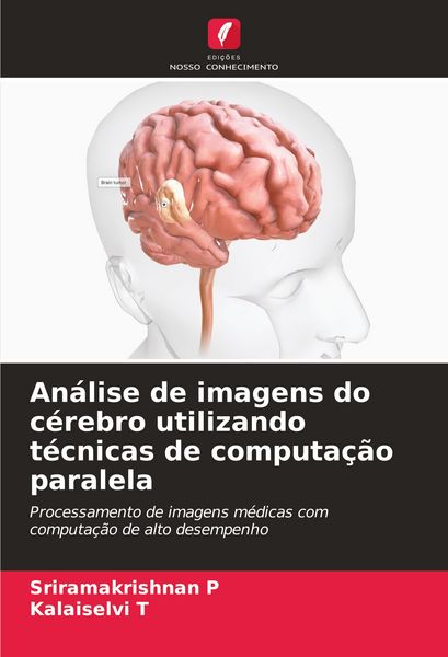 Produktbild: An&aacute;lise de imagens do c&eacute;rebro utilizando t&eacute;cnicas de computa&ccedil;&atilde;o paralela