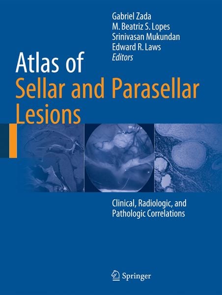 Produktbild: Atlas of Sellar and Parasellar Lesions